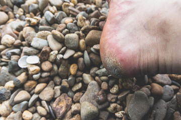 Fototapeta premium Bare heel of a person lying on water worn pebbles