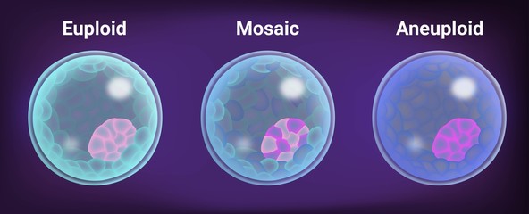 Embryo selection of human blastocyst after preimplantation genetic testing for aneuploidy from a biopsy taken after IVF or ICSI process, 3D illustration
