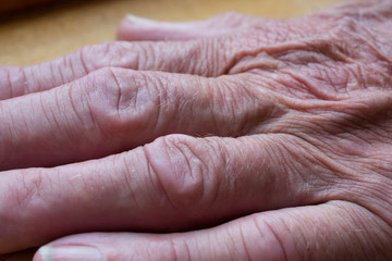 Macro image of wrinkles on an old mans hand