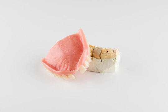 image of a modern denture nylone