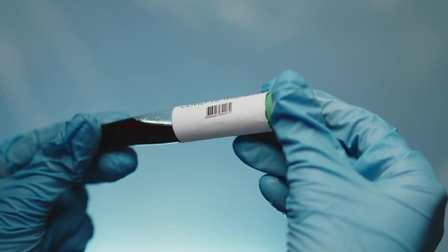 Closeup of microbiologist or medical worker hand with blue surgical gloves looking blood test result as positive for the new rapidly spreading Coronavirus. pandemic and epidemic COVID Positive concept