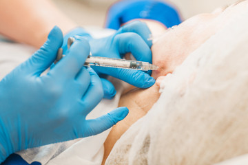 hyaluronic acid injections allow the skin to return to its previous appearance, it becomes smoother, moisturized and well-groomed