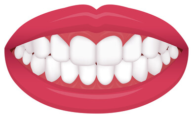 Teeth trouble ( bite type / crooked teeth ) vector illustration / even teeth., normal teeth