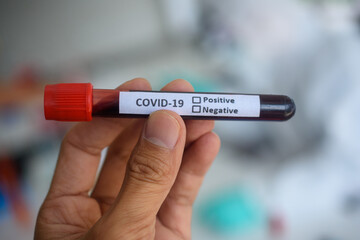 Doctor, scientist, researcher Currently studying and analyzing blood samples of corona virus patients 2019 for use in research and experiment in medicine for treatment of patients in hospitals.