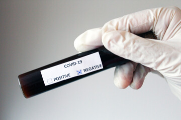 Obraz premium Negative blood test result for Coronavirus. Corona Virus 2019-nCoV blood sample in hospital.