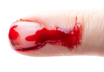 The finger cut by a knife is isolated on a white
