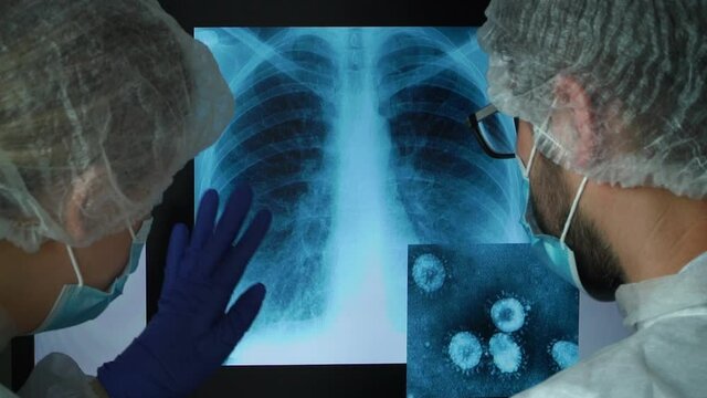Team of scientists at computer monitor in laboratory discuss x-ray of patient with lung pneumonia caused by coronavirus. COVID-19