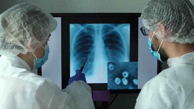 Team of doctors sits at computer monitor in laboratory and discusses lung x-ray with pneumonia and photo of Coronovirus under microscope. COVID-19