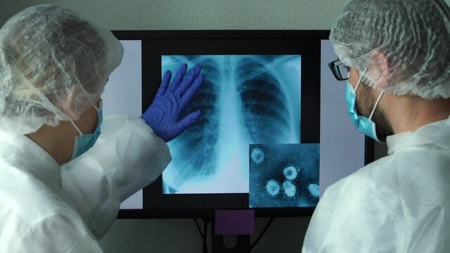 Team of scientists sits at computer monitor in laboratory and discusses lung x-ray with pneumonia and photo of Coronovirus under microscope.