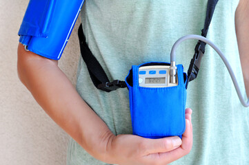 Woman wearing holter monitor device for daily monitoring of an electrocardiogram. Health care and...