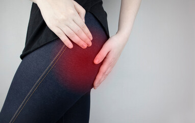A woman suffers from pain in the buttock. The doctor diagnoses the patient piriformis syndrome,...