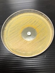 staphylococcus aureus and antisesceptibility testing
