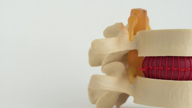 Model of the lumbar spine with intervertebral discs and vertebrae on a white background, isolate. The concept of diseases of the spine of the lower back, spinal stenosis, ankylosing spondylitis