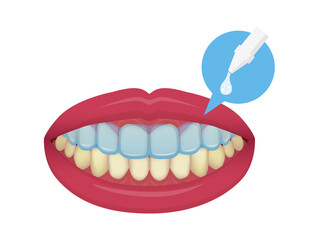 Teeth whitening at home vector illustration / no text