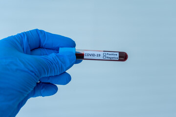Obraz premium hands of medical doctor scientist wearing protective blue gloves holding sample tube blood sample in science laboratory equipment to diagnosis for corona virus covid-19 virus pandemic