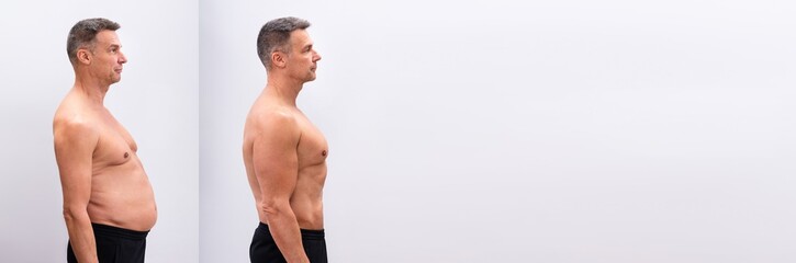 Man Before And After Loosing Fat