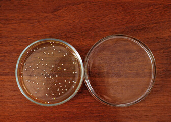 A Petri dish with microbe colonies on a mahogany table