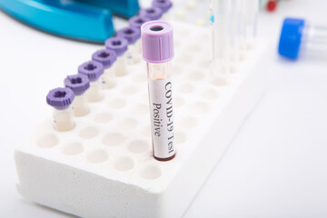 Test tube with a positive COVID-19 test on a white background