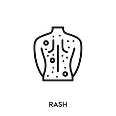 rash icon vector. rash sign symbol.