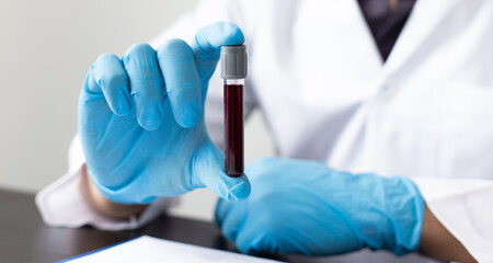 Scientists or doctors collect blood samples from new strains of virus patients for analysis and...