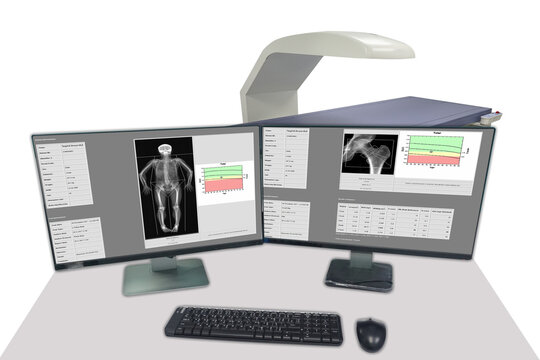 Soft and blurry image: special examination medical image showing on LCD moniter Lumbar spine and hip joint ,Osteoporosis bone density on arrow point.Healthcare concept.