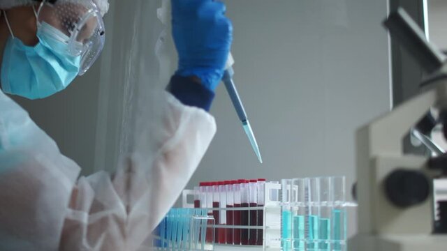 Laboratory assistant uses a pipette dispenser for laboratory tests to diagnose coronavirus. A researcher examines blood samples of a Covid-19 coronavirus infected
