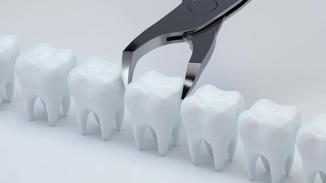 Animation of install the new tooth, 3d rendering.