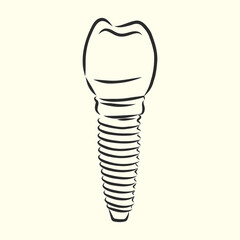 Vector illustration. sketches, dental implants. dental implant, vector sketch illustration