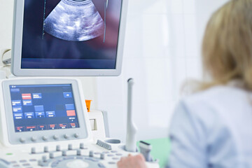 The doctor examines the patient on a computer. Ultrasound machine