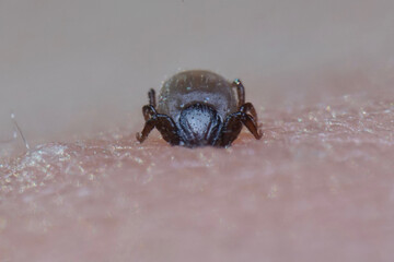 Super close up of sucking Ixodes ricinus on human skin. Adults feed on large mammals such as sheep, cattle, dogs, deer, humans, and horses for 6–13 days, before dropping off.