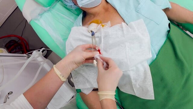 a nurse in medical gloves processes a dialysis catheter solution. First-person view