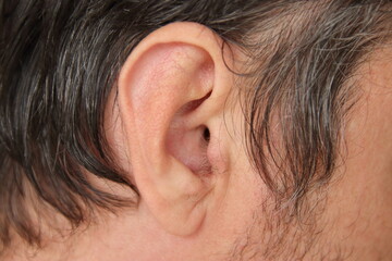 ugly hair on the ear, removal