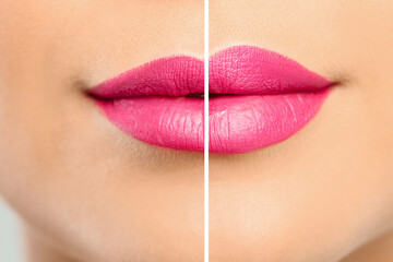 Woman before and after lip correction procedure, closeup