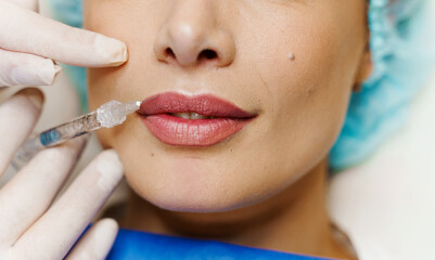 Closeup lips augmentation injections for attractive girl. Plastic surgeon does injection in lip in...