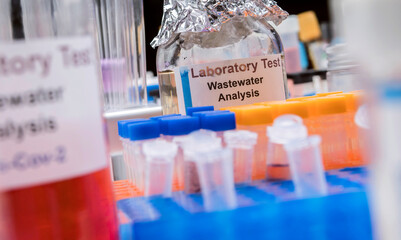 Wastewater samples, analysis of sars-cov-2 virus in patients infected by human coronavirus 229E, conceptual image