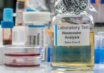 Wastewater samples, analysis of sars-cov-2 virus in patients infected by human coronavirus 229E,...