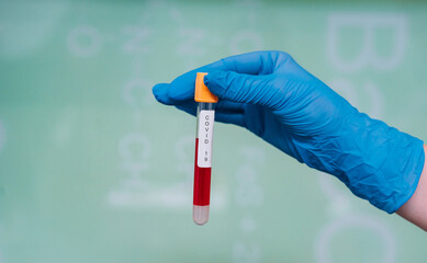 A rubber-gloved hand holds one test tube with coronavirus