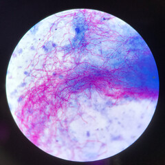 Red branching mycobacterium tuberculosis on blue background in modified acid fast bacilli stain.