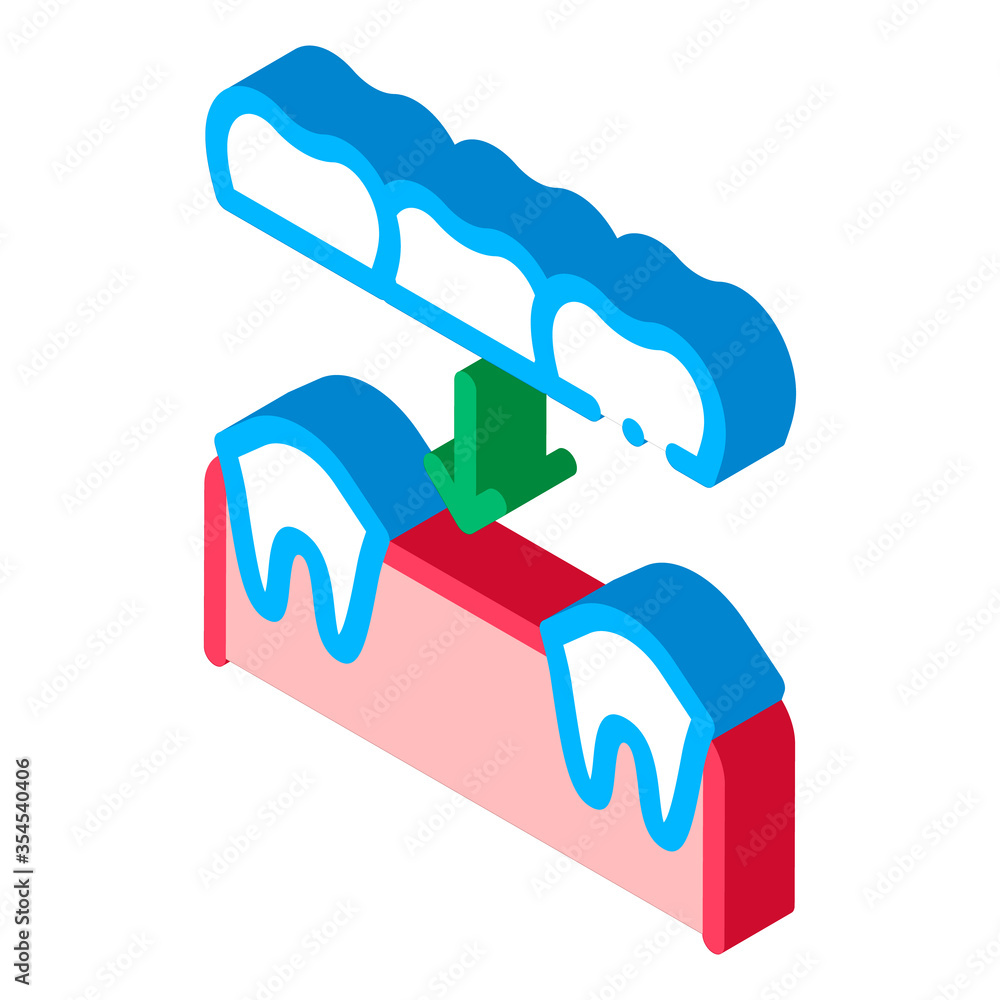 Wall mural Dental Prosthesis Stomatology vector isometric sign. color isolated symbol illustration