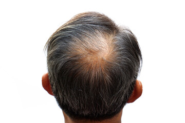 Close up back of the head of old aisan man with hair loss problem isolated on white background.                            