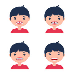 A kid before and after using dental aligner braces. Corrective treatment of a child. A process of crooked teeth alignment. Little boy being sad and happily smiling.