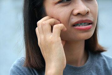 itching woman scratching her skin