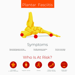 Plantar fasciitis anatomy scheme. Poster