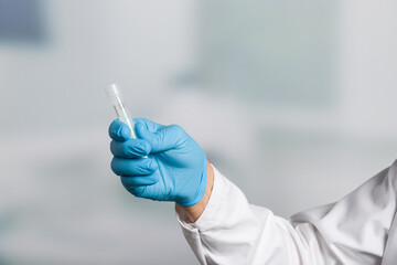 doctor's hand with a stool sample test tube for colon cancer screening