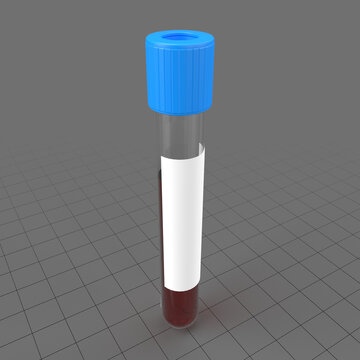 Blood sample in test tube