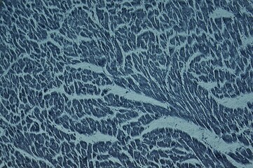 Cardiac muscle sec. heart under microscope