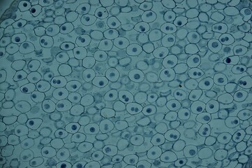 Mitosis Horse Ascaris Eggs under microscope