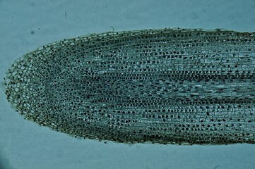 Mitosis onion root tip cells under microscope