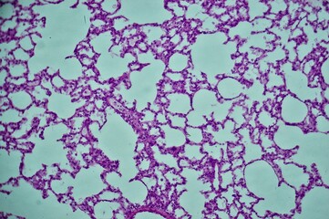 Rat lung with blood cessels injected sec. under microscope
