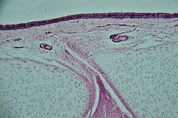 Dense bone sec. under microscope